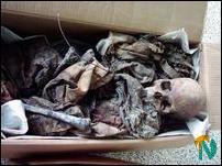 Skeletal remains in Sithamparapuram, Vavuniya